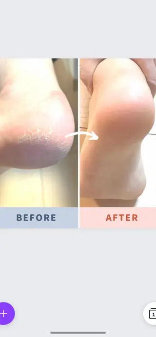 ネイル Nail care PONOのネイルデザイン