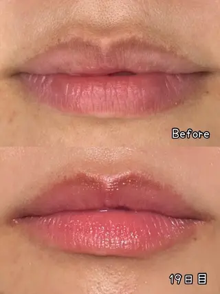 Esthesalon MOONのその他イメージ