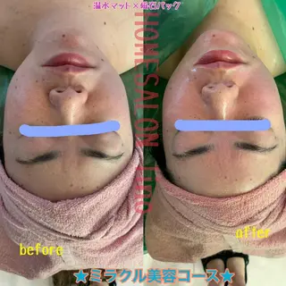 HOME SALON linoのエステ・リラクイメージ