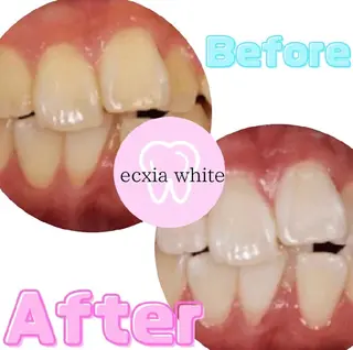 nanami -ホワイトニングのその他イメージ