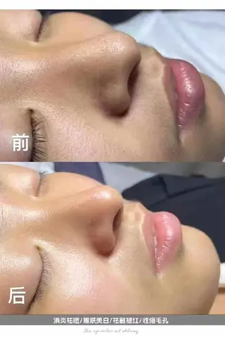 Healing  SpaceEasenのエステ・リラクイメージ