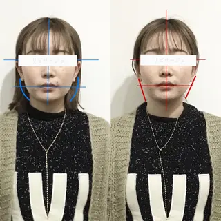 顔の歪み矯正専門 宮内翔のエステ・リラクイメージ