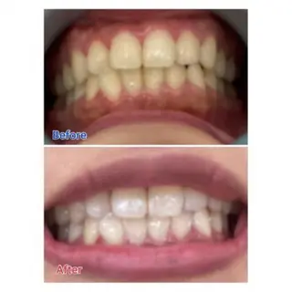 Ｍ渋谷 ホワイトニングのエステ・リラクイメージ