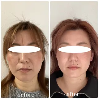 小顔・歪み専門　井元 朋子のエステ・リラクイメージ