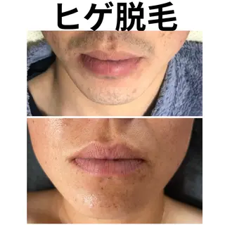 食べながら魅せボディ éclatJua川越のエステ・リラクイメージ