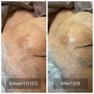 bloom ブルームのエステ・リラクイメージ