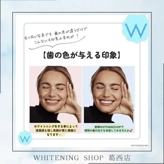 メンズ ホワイトニング ショップ葛西店のその他イメージ