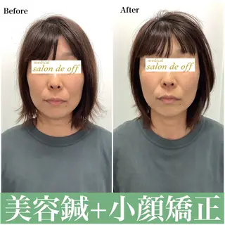 ハリサロンドオフ 美容鍼灸×小顔整体のエステ・リラクイメージ