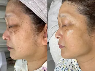 mone~total care salon~所属・mone (モーネ)のエステ・リラクイメージ