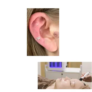 ピーリング＆脱毛 maoのエステ・リラクイメージ