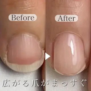ネイル 深爪専門店 サロンリリーのネイルデザイン