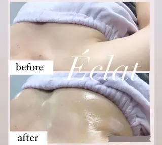 マツエク・マツパ アイブロウ É clatのマツエク・マツパデザイン