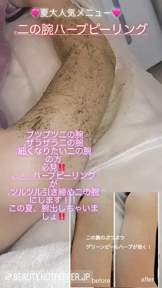 ハーブピーリング専門 毛穴洗浄❤️眉waxのエステ・リラクイメージ