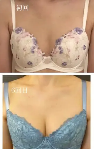 肌質改善サロン mimyのエステ・リラクイメージ