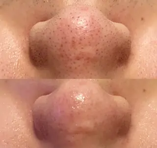 Butterfly 平塚店　佐藤のエステ・リラクイメージ