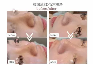 Hisui 種村のエステ・リラクイメージ