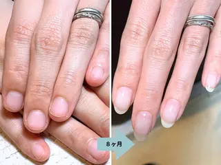 ネイル 深爪矯正・自爪育成 ネイルサロンアモここのネイルデザイン