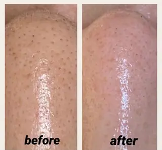 Frele Komiのエステ・リラクイメージ