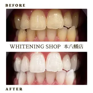 メンズ ホワイトニング ショップ本八幡店のエステ・リラクイメージ