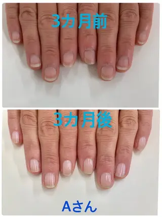 ネイル 自爪育成専門店 Kapilinaのネイルデザイン