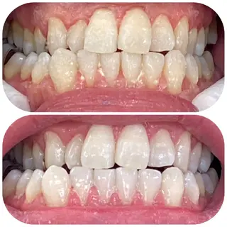 メンズ ホワイトニングカフェ藤が丘店所属・ホワイトニングカフェ 藤が丘のその他イメージ