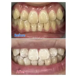 M渋谷 ホワイトニングのエステ・リラクイメージ