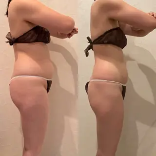 Re:Oasis所属・🦋痩身専門サロン Re:oasis🦋のエステ・リラクイメージ