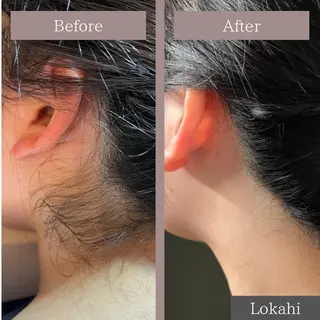 脱毛サロン Lokahiのエステ・リラクイメージ