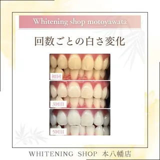 メンズ ホワイトニング ショップ本八幡店のエステ・リラクイメージ