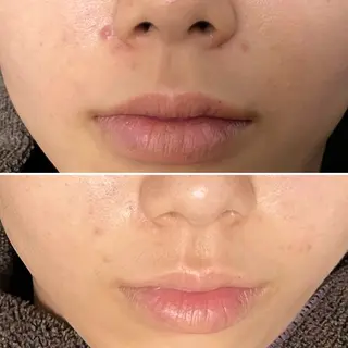 アーユルヴェーダ専門 スローガーデンのエステ・リラクイメージ