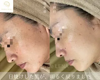 ハーブピーリング専門 サロンドレナ平岡のエステ・リラクイメージ