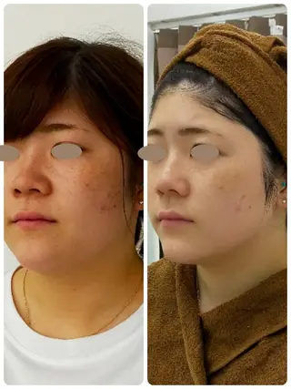 【小顔・美容専門】 🐠リカのエステ・リラクイメージ