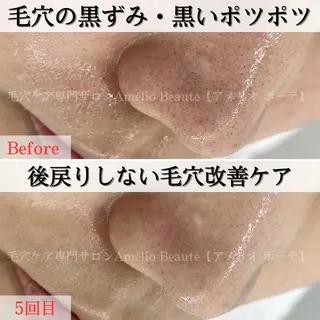 毛穴ケア専門サロン アメリオボーテのその他イメージ