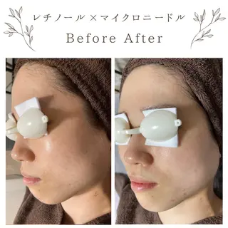 な ぎのエステ・リラクイメージ