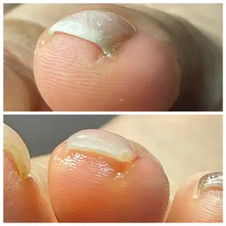 ネイル Wind.ウィンドネ イルケア耳つぼ専門店のその他イメージ