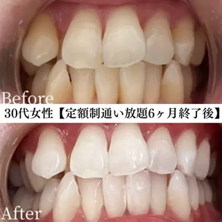 キッズ メンズ セルフホワイトニング WHITE福岡天神店のエステ・リラクイメージ