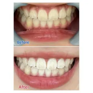 Ｍ渋谷 ホワイトニングのエステ・リラクイメージ