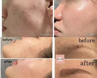 marron所属・痩身ハイパーナイフ ララピールリアボーテのエステ・リラクイメージ