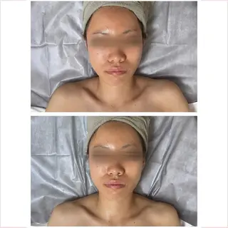 MELIA the beauty所属・肌のお悩み改善サロン MELIA/朋美のエステ・リラクイメージ