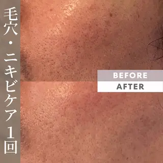 メンズ C's Beauté 【シーズボーテ】のエステ・リラクイメージ