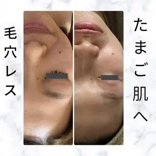 リラクゼーションエステサロン🌺肌質改善イアリイ所属・肌質再生 〜イア🌺リイ〜のエステ・リラクイメージ