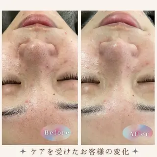 LBSホワイトニング 🌐岡山店のその他イメージ