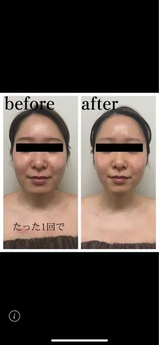 フェイシャルサロン オーガニックロハスのエステ・リラクイメージ