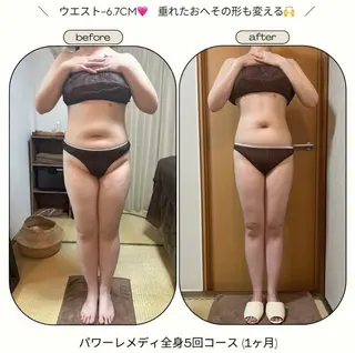 《本気痩せ×疲労改善 》  BILOOPのエステ・リラクイメージ