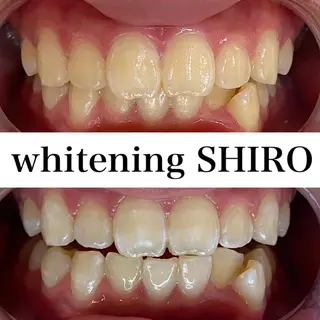 福岡ホワイトニング SHIRO天神店のエステ・リラクイメージ