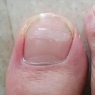 ショート キッズ ネイル 🌱 ま　し　お　🌱のエステ・リラクイメージ