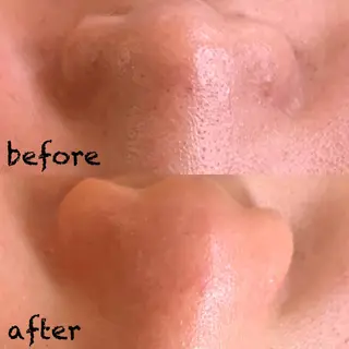 美肌蘇生カウンセラー 横山りえのエステ・リラクイメージ