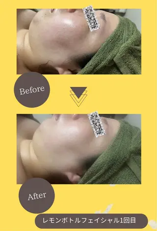 バスト美肌小顔専門 Mimpi【ミンピ】のエステ・リラクイメージ