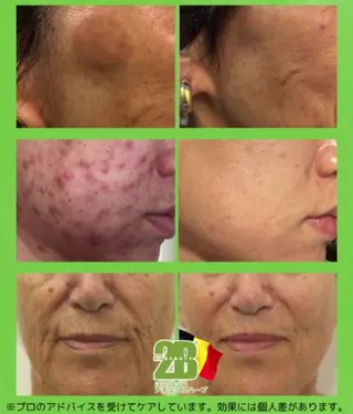 Arebeau 健康的にダイエットのエステ・リラクイメージ