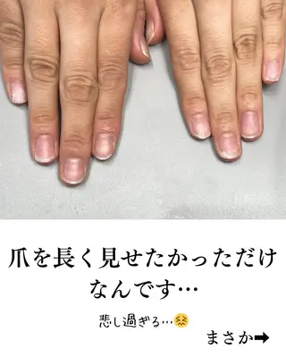 ネイル Aim* 深爪自爪育成専門店のネイルデザイン